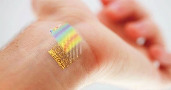 implant